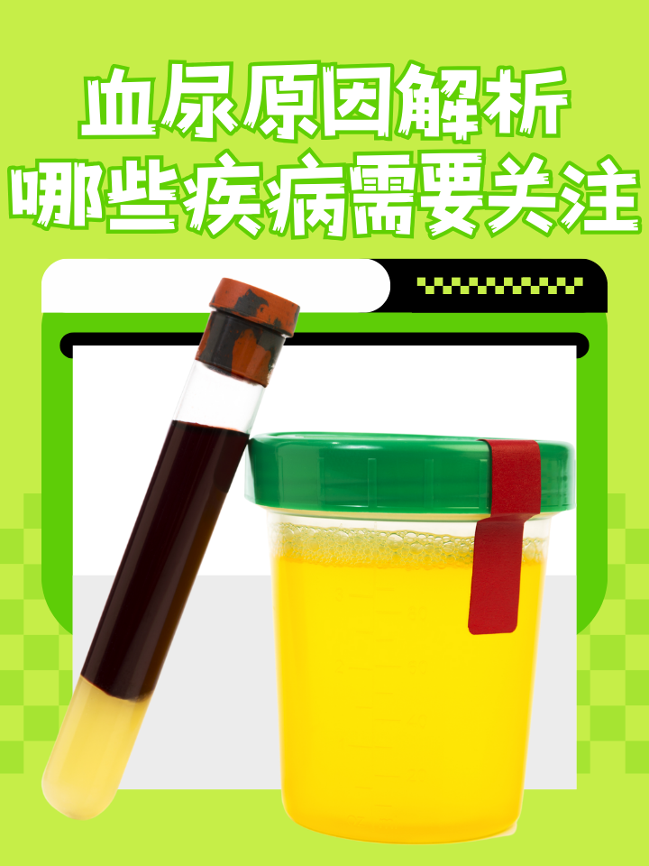 血尿原因解析:哪些疾病需要关注?