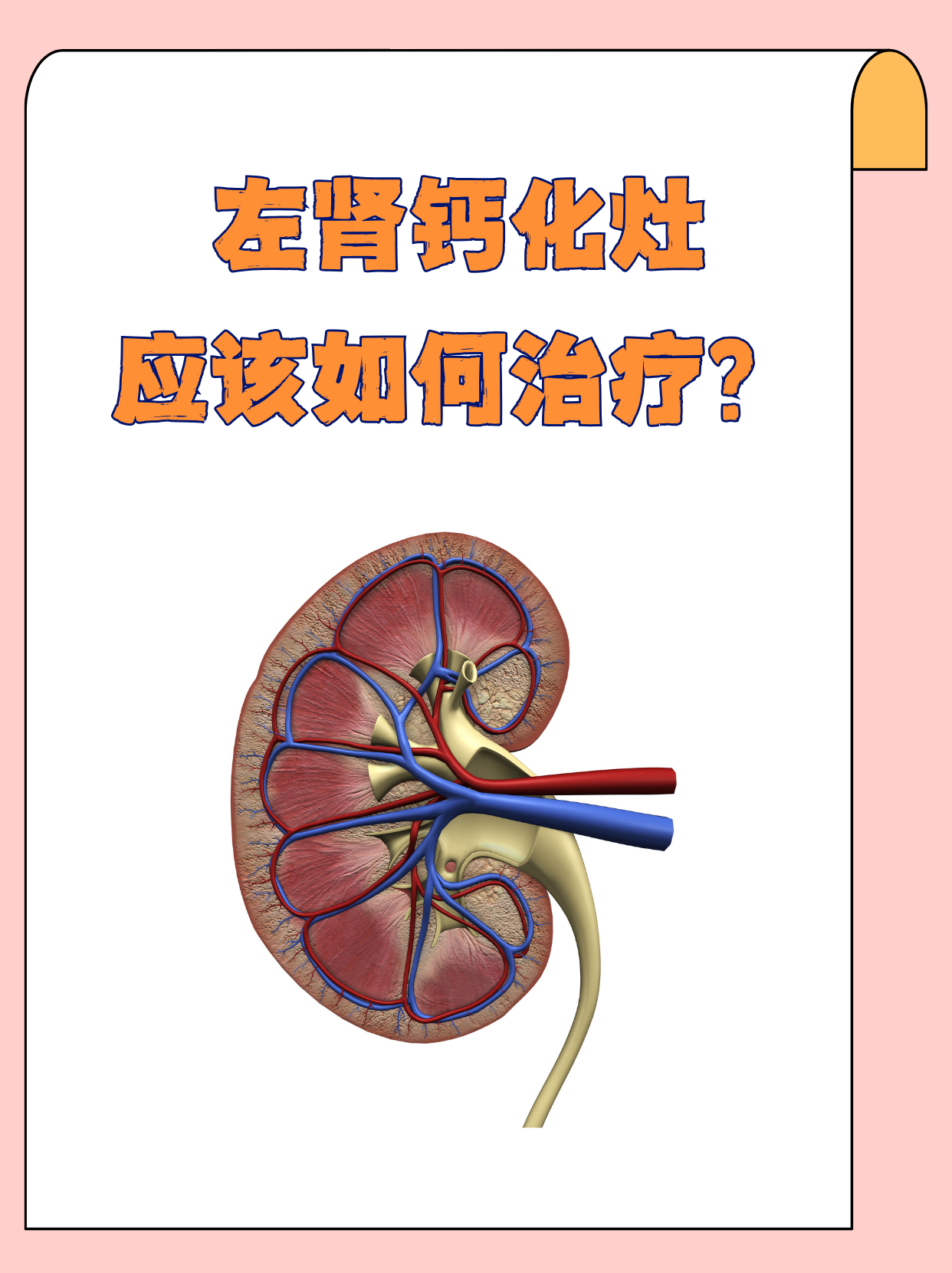 为什么会钙化 为什么会钙化