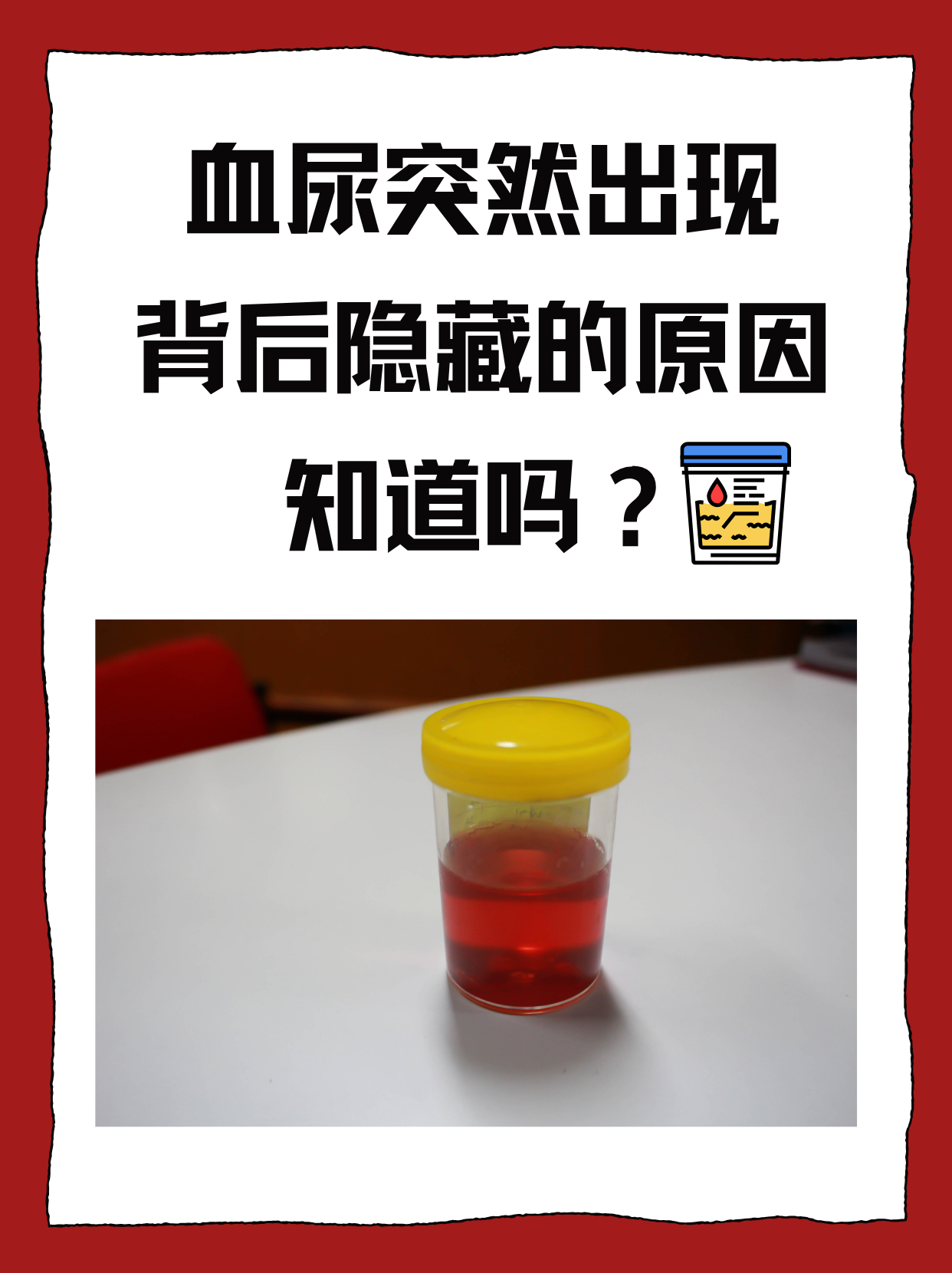血尿是一种常见的泌尿系统症状,医学上称为"肉眼血尿",可能由多种