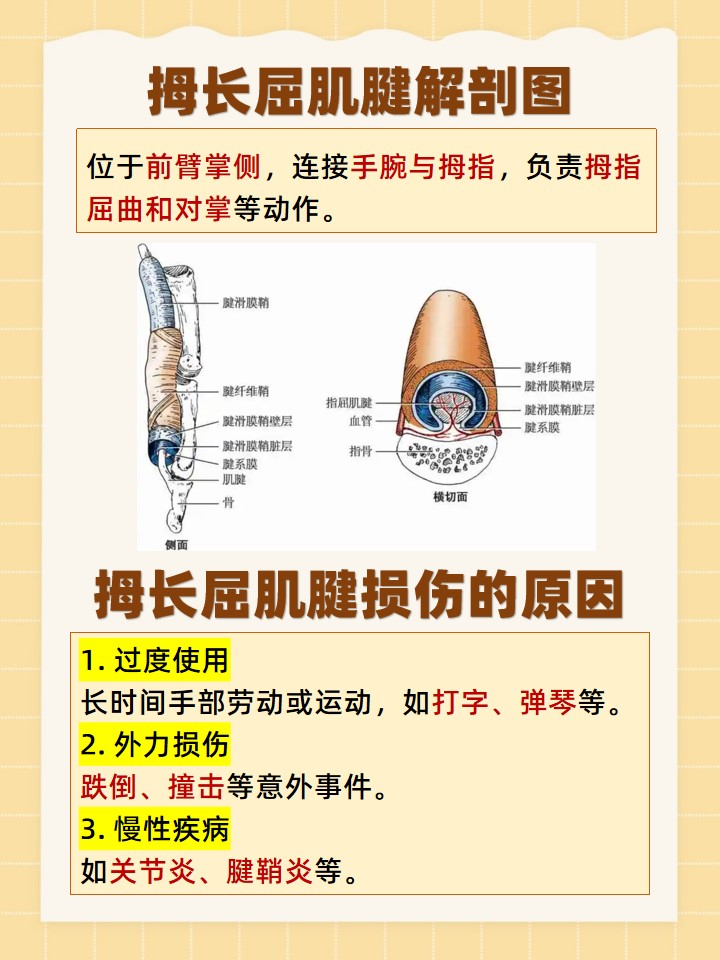 一,拇长屈肌腱解剖图 拇长屈肌腱位于前臂的掌侧