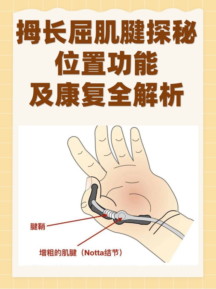 一,拇长屈肌腱解剖图 拇长屈肌腱位于前臂的掌侧