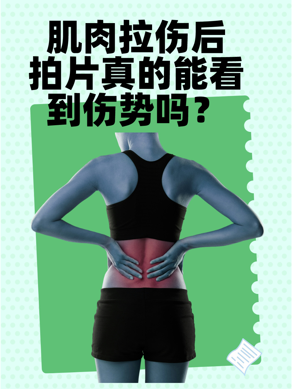 因此,单纯的x光片可能无法直接显示肌肉拉伤的情况