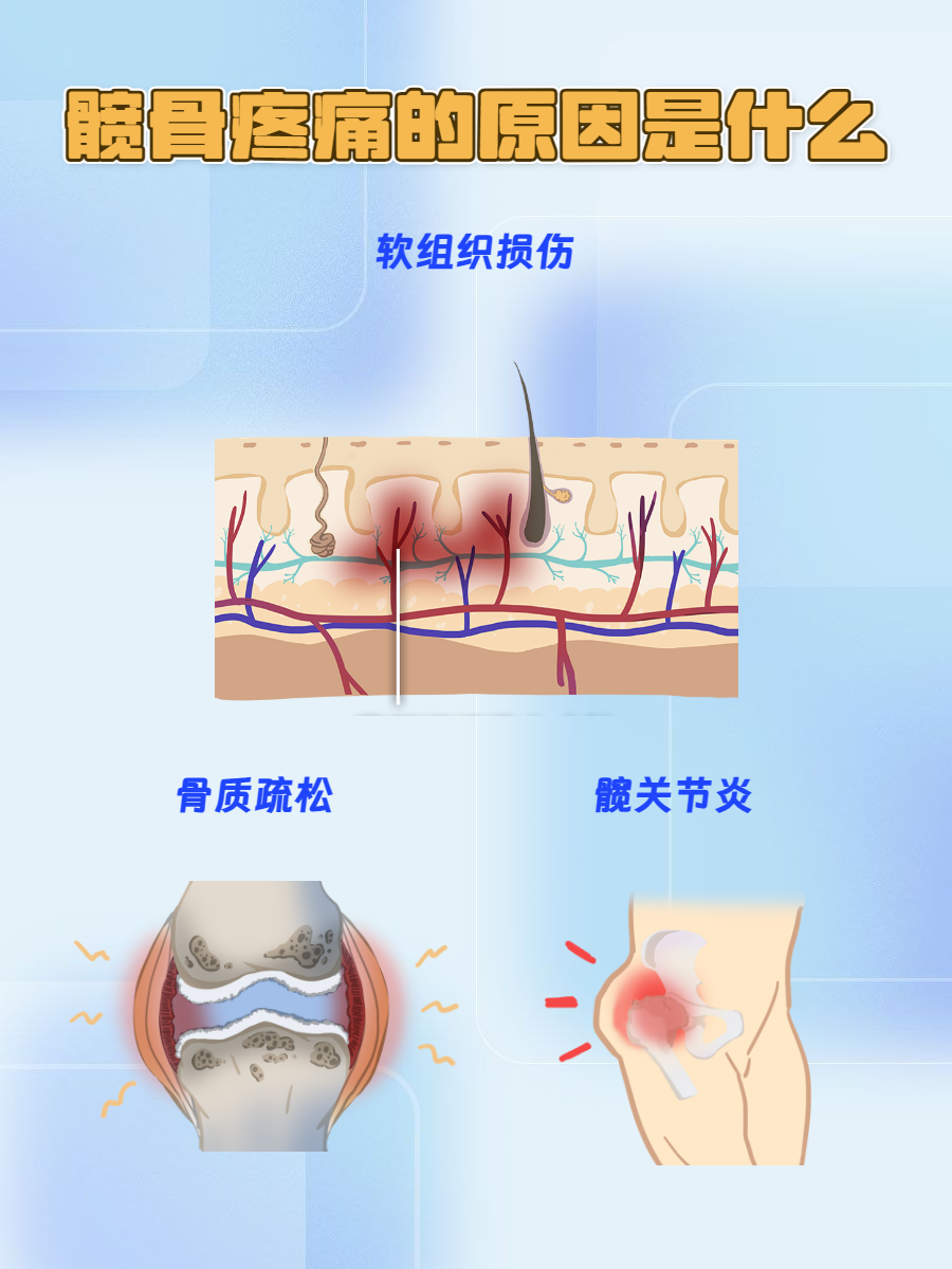 右侧髋骨疼痛的原因图片