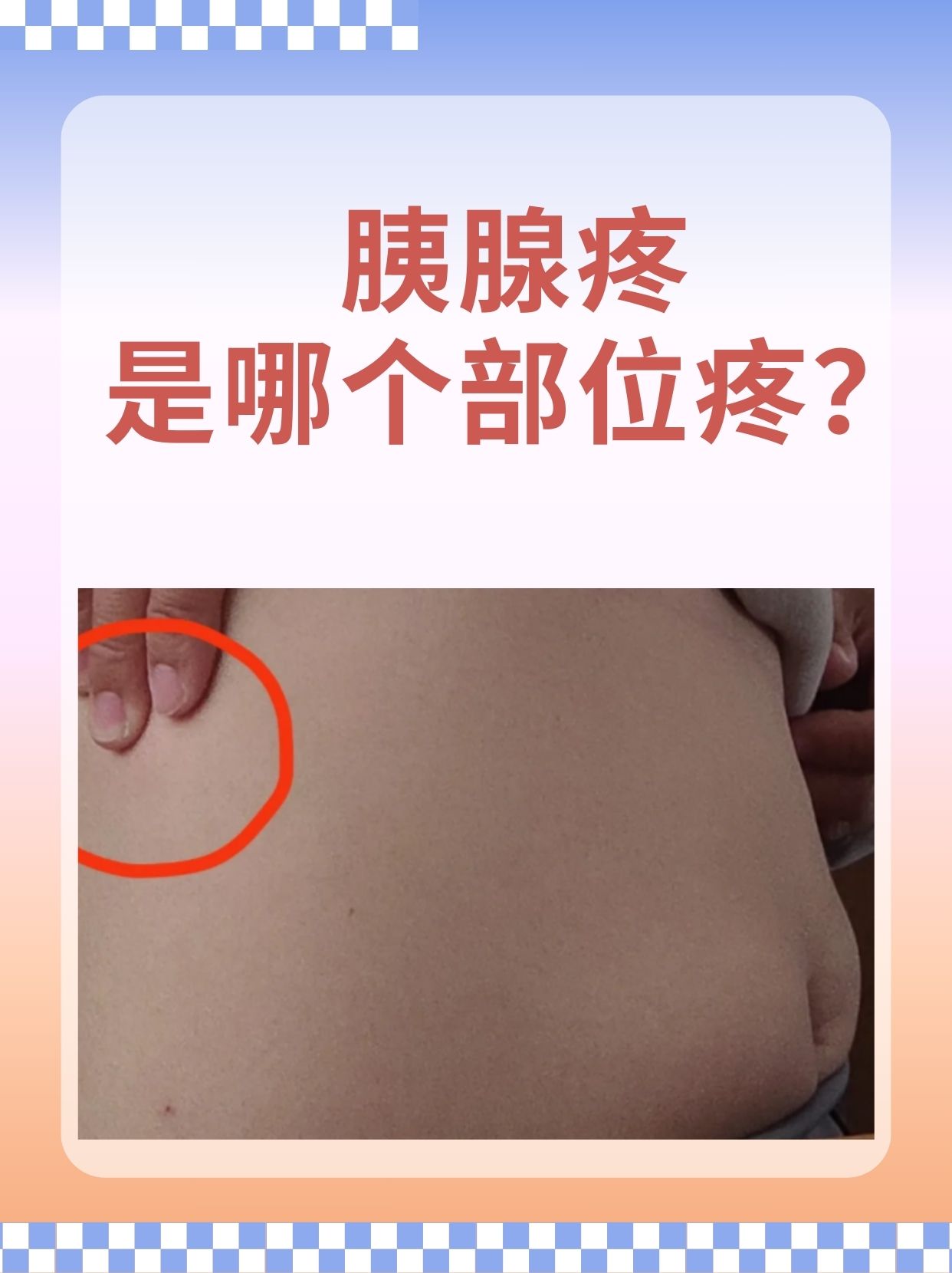 胰腺会疼吗图片