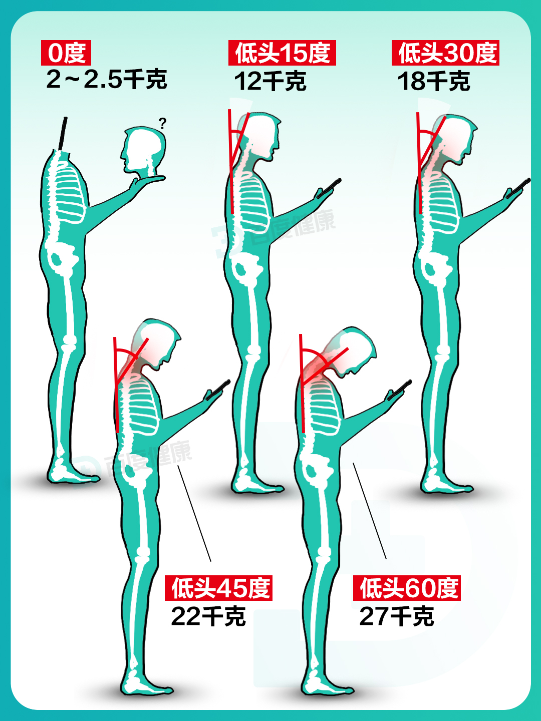随着低头的角度增加 脖子承受的压力和肌肉的拉扯会递增 颈椎在低