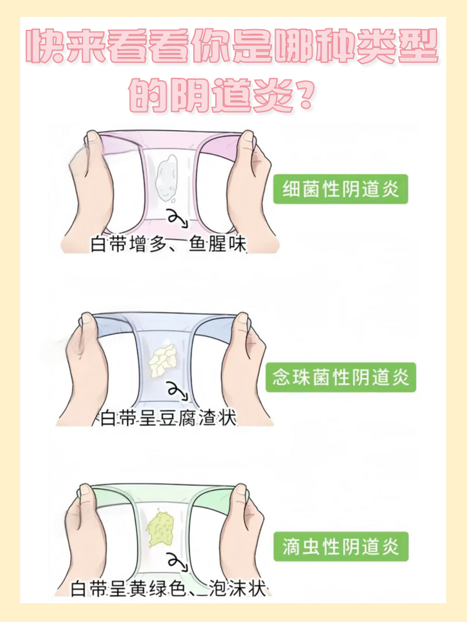 滴虫性阴道炎的正确处理方式!