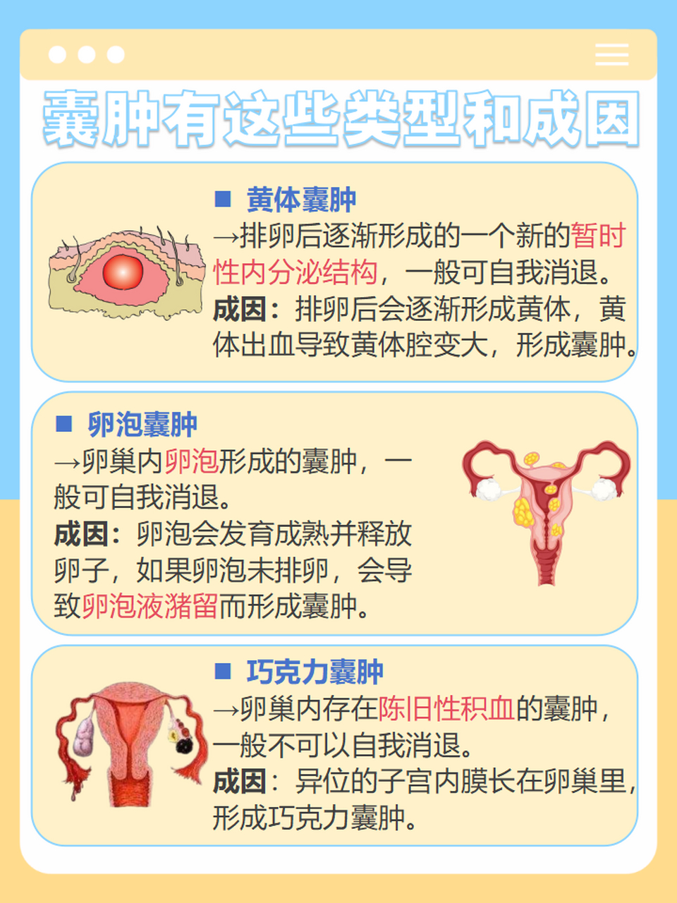 盆腔囊肿位置图图片