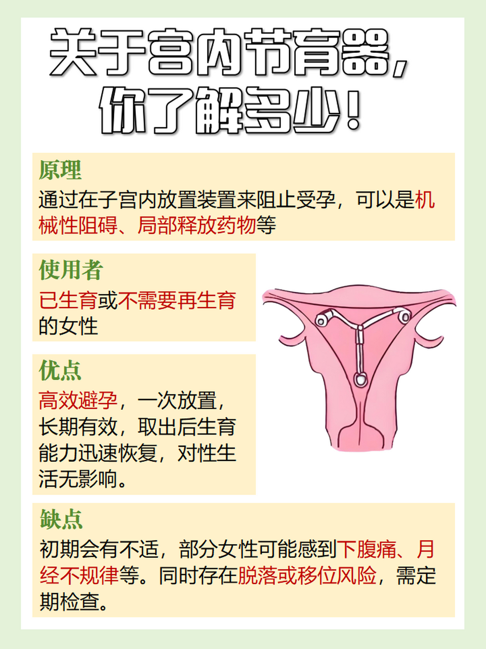 女性上节育环图片