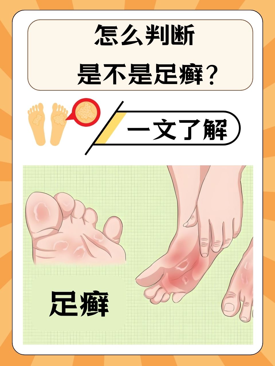 女生为什么有脚气为什么在线