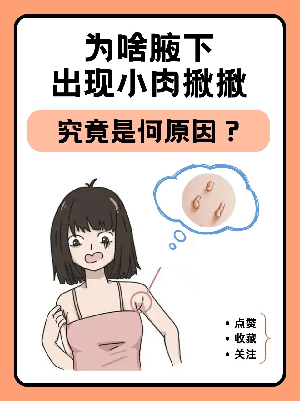 腋下长小肉揪揪的主要原因和