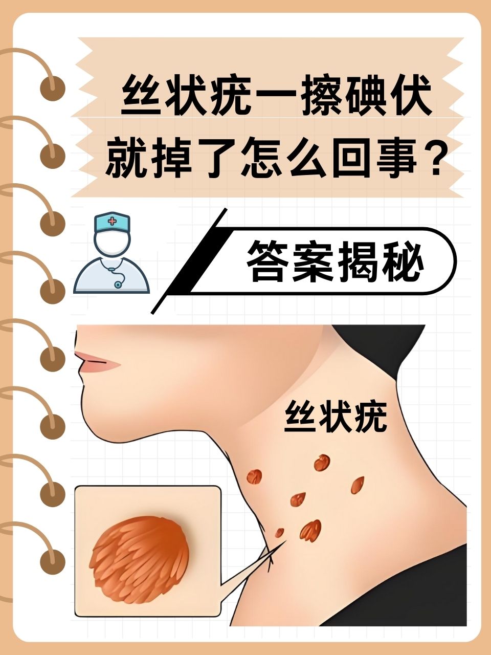 为什么会得人乳头瘤病毒