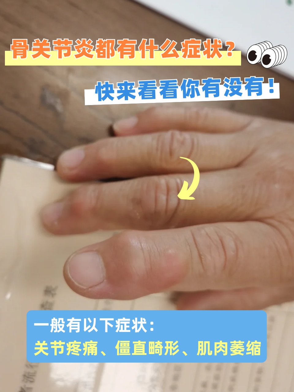 骨关节炎都有什么症状?快来看看你有没有!