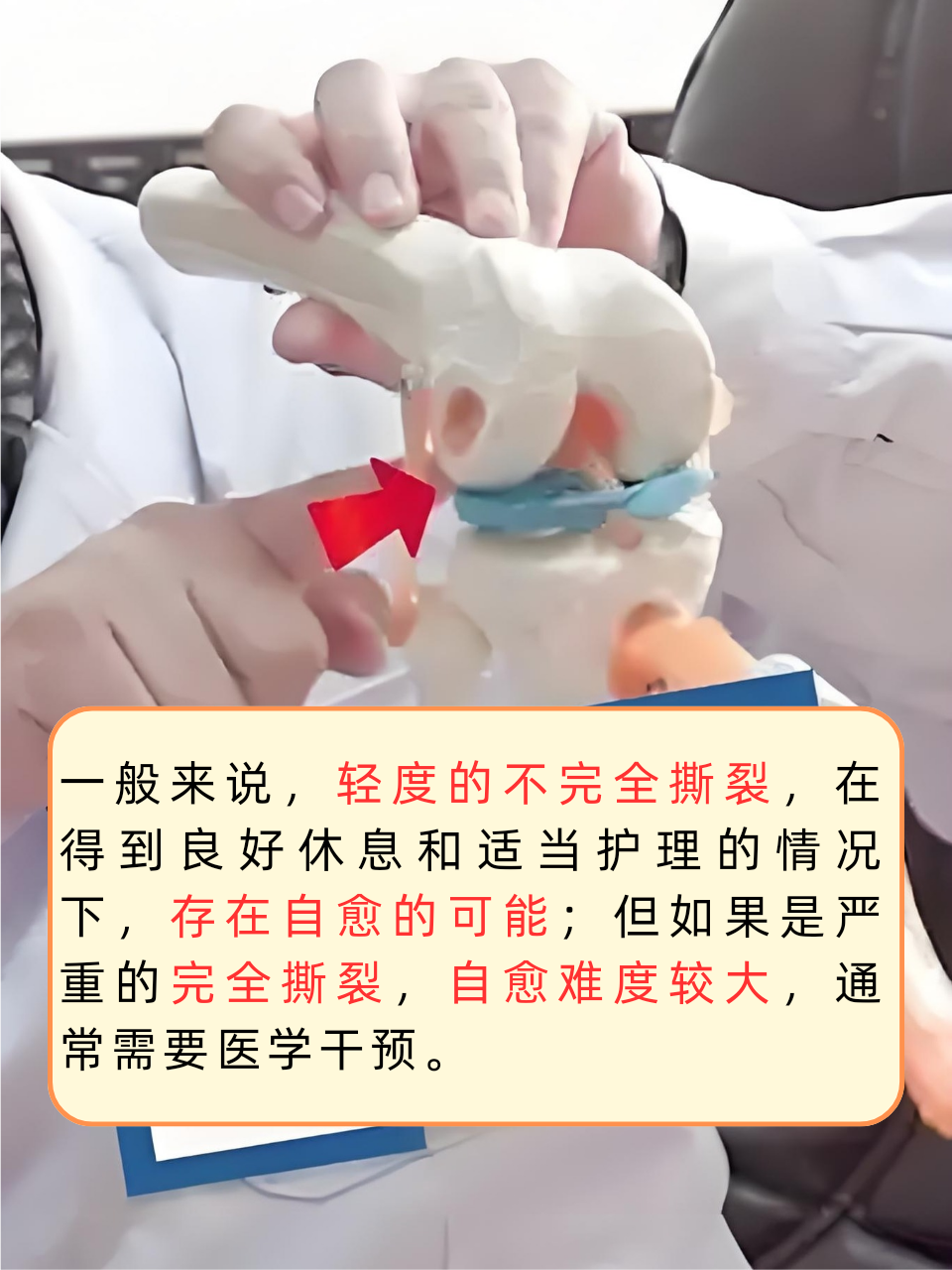 外侧半月板前角撕裂能自愈吗?