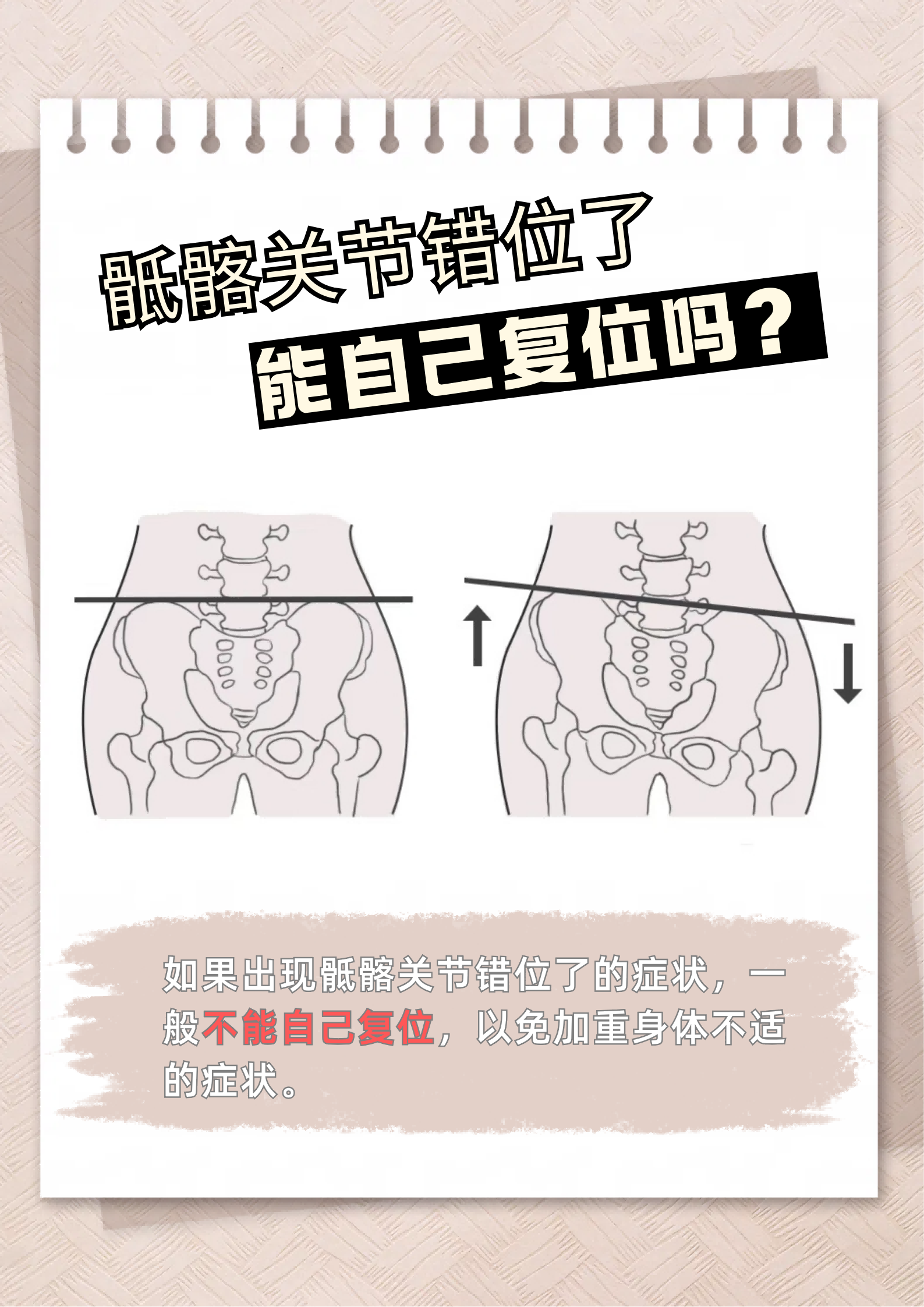 腰痛到不能翻身?骶髂关节错位千万别乱扳!