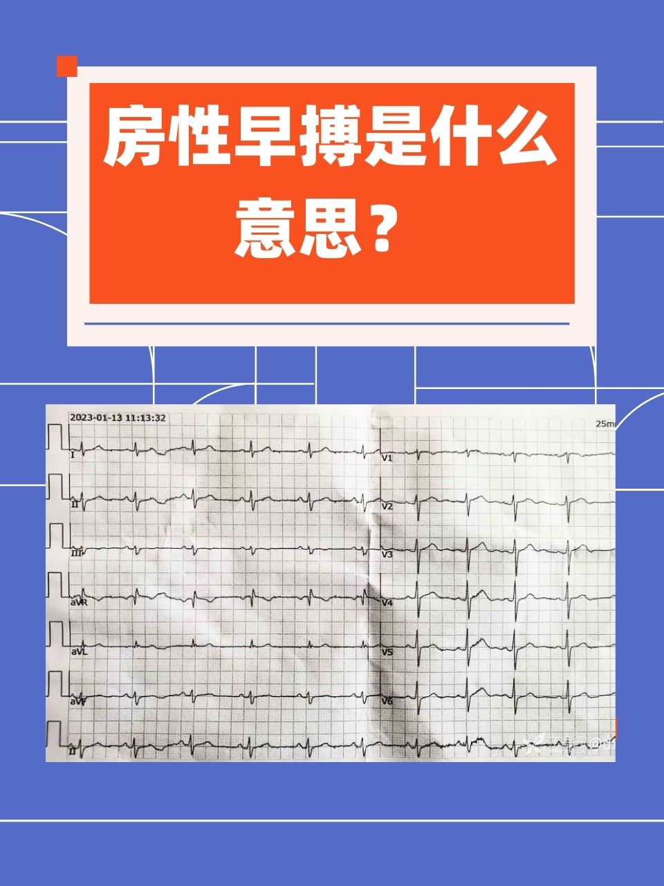 房性早搏属于是一个常见的心脏小问题,基本不会对我们的身体造成太