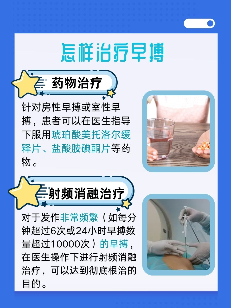 早搏,是我们日常生活中可能遇到的一种心脏"小插曲".