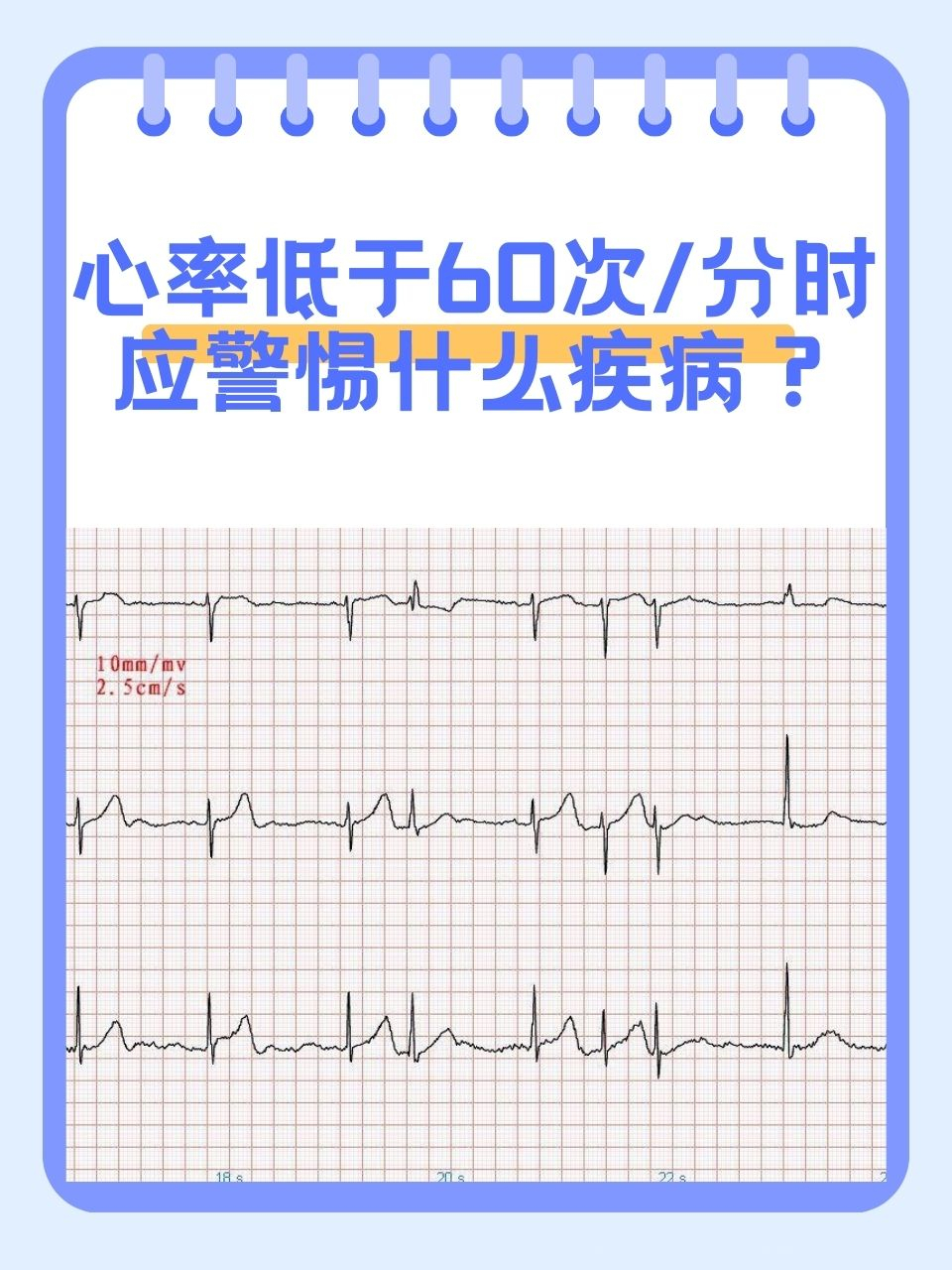 心跳正常范围图片