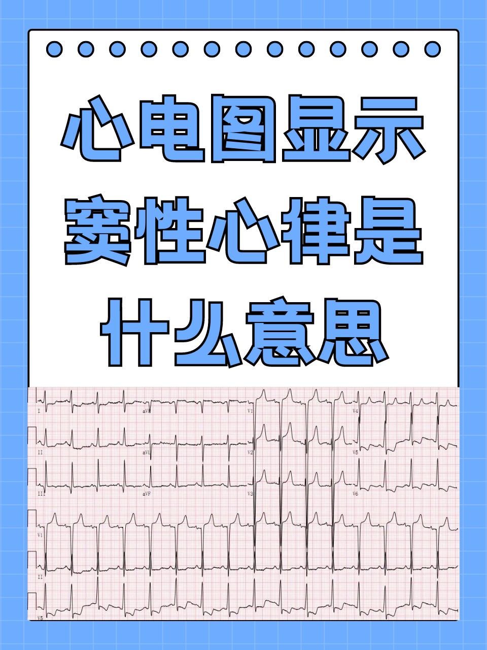 当你拿到心电图报告,看到"窦性心律"这几个字时,心中或许会有一丝疑惑