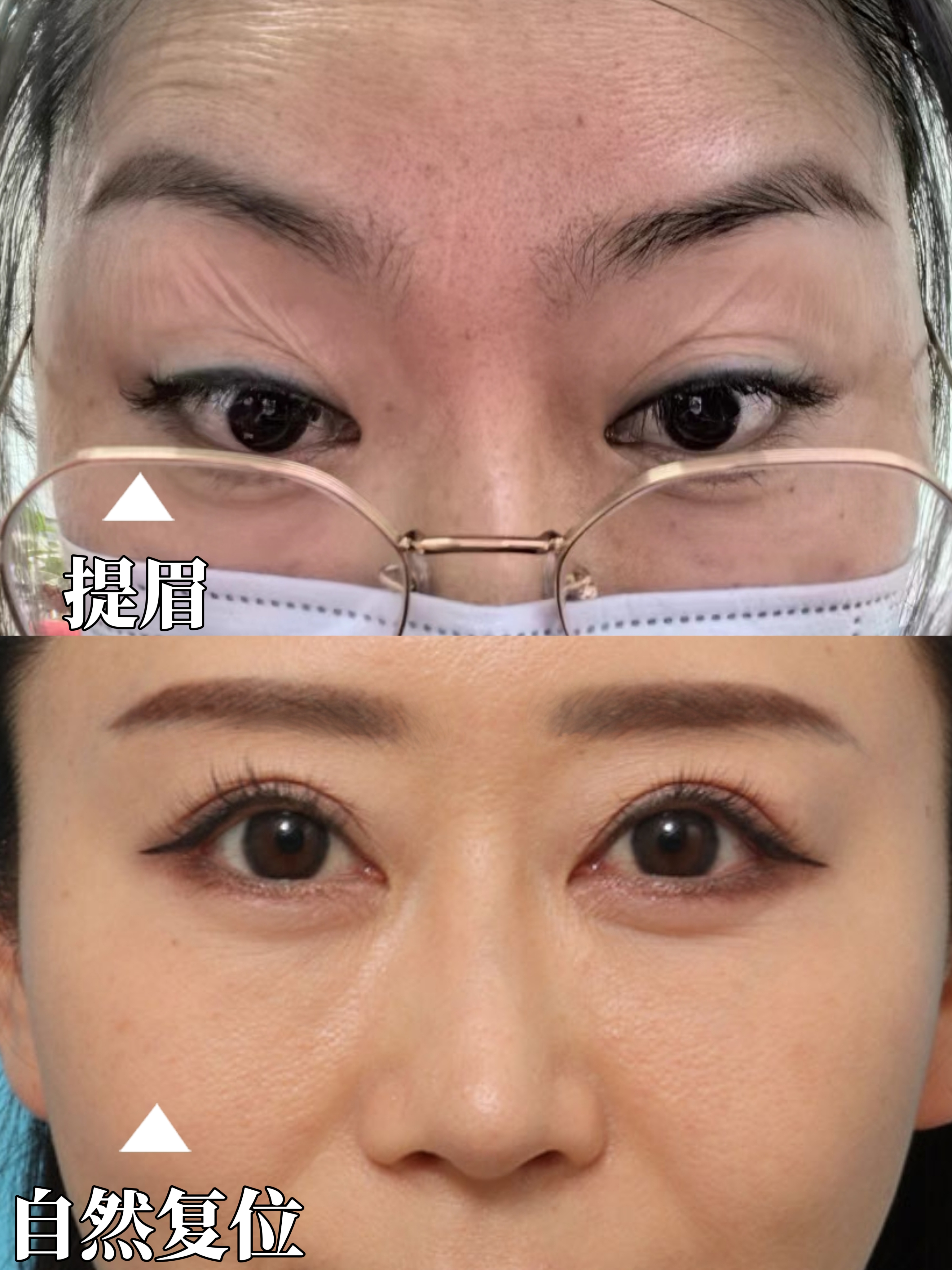 说个冷知识提眉是有年龄限制的