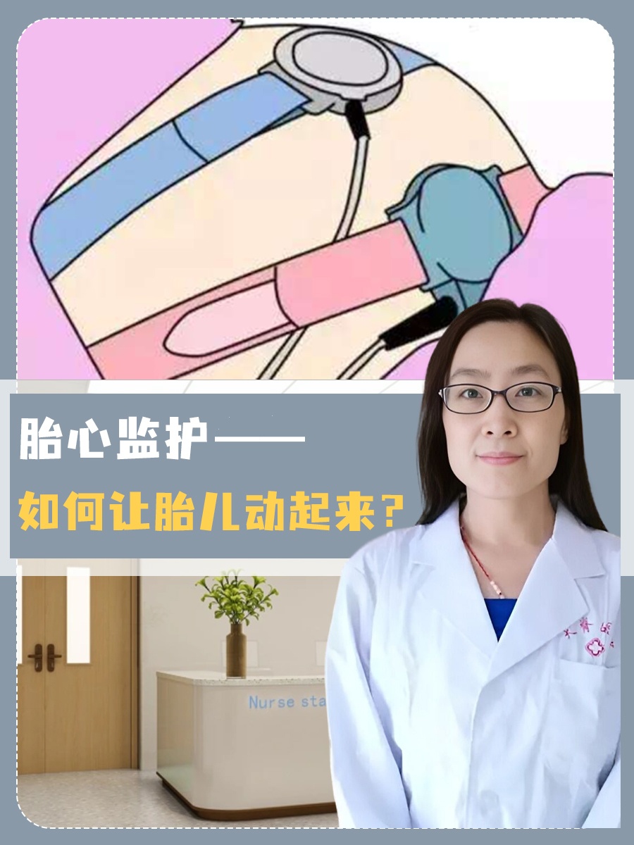 孕33周胎心位置图片图片