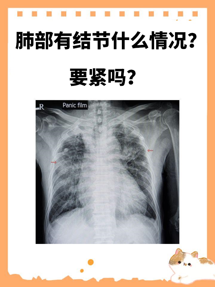肺部健康自测：居家妙招 vs. 专业检查，哪个更准？