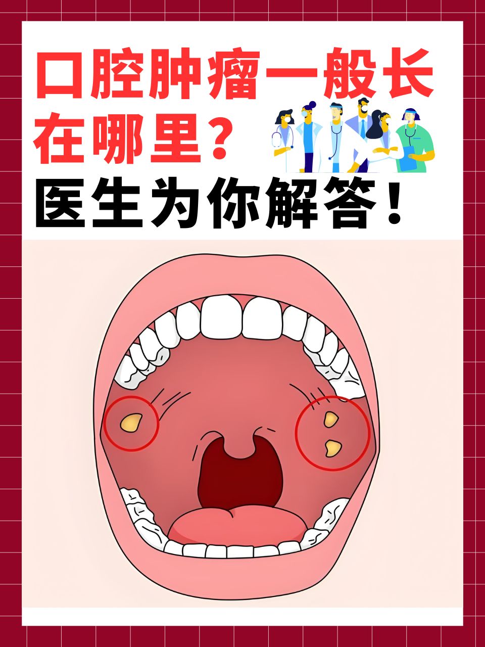 为什么会得口腔癌 为什么会得口腔癌