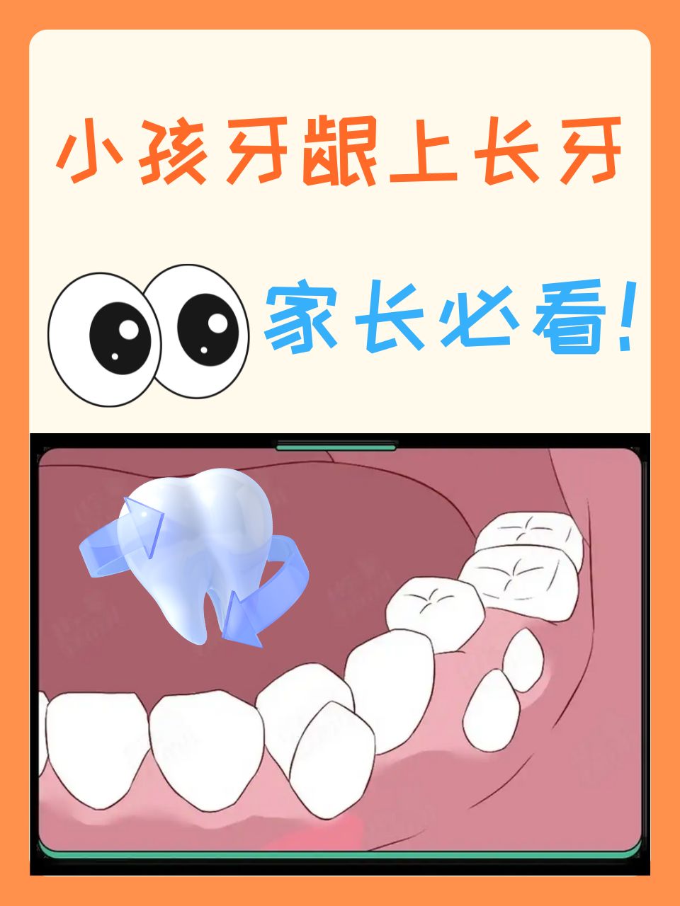 当家长们发现自家小孩的牙龈上竟然长出了牙齿,心里肯定既惊讶又