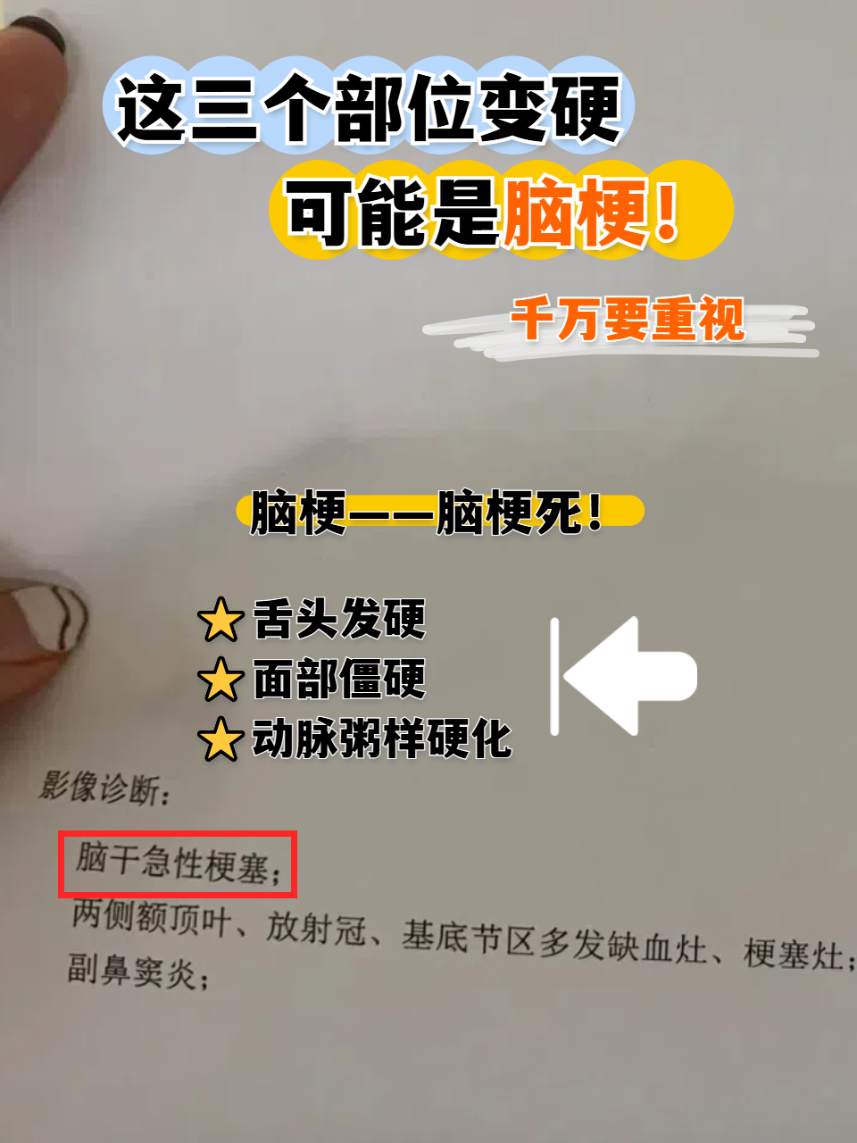 脑梗为什么老睡觉不醒为什么在线