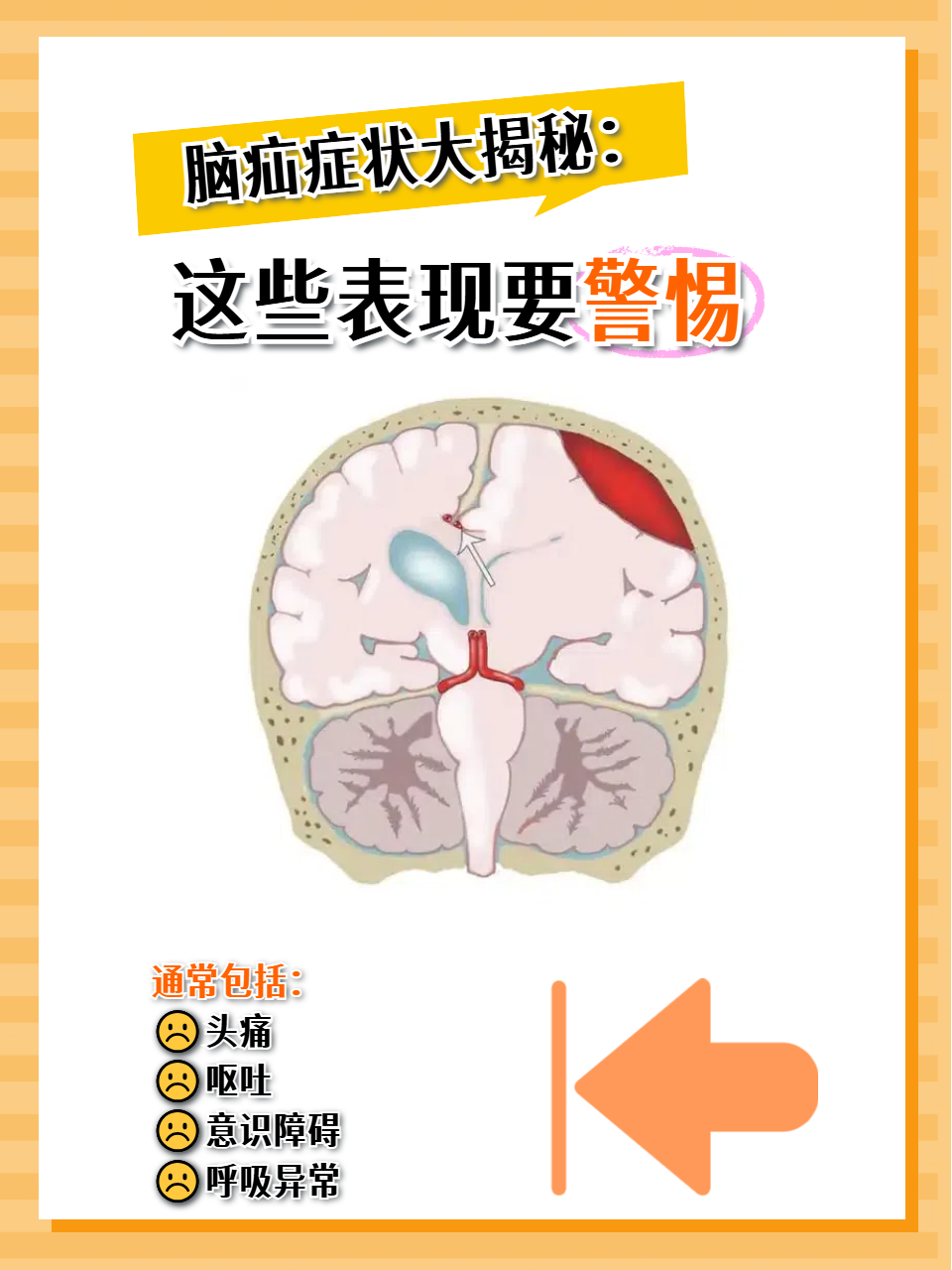 今天,就为大家大揭秘脑疝症状,这些表现一定要警惕,关键时刻能救命!