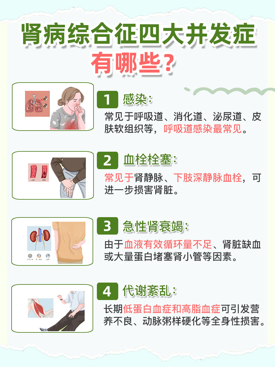 肾病综合征是一种由多种原因引起的临床综合征,主要表现为大量蛋白