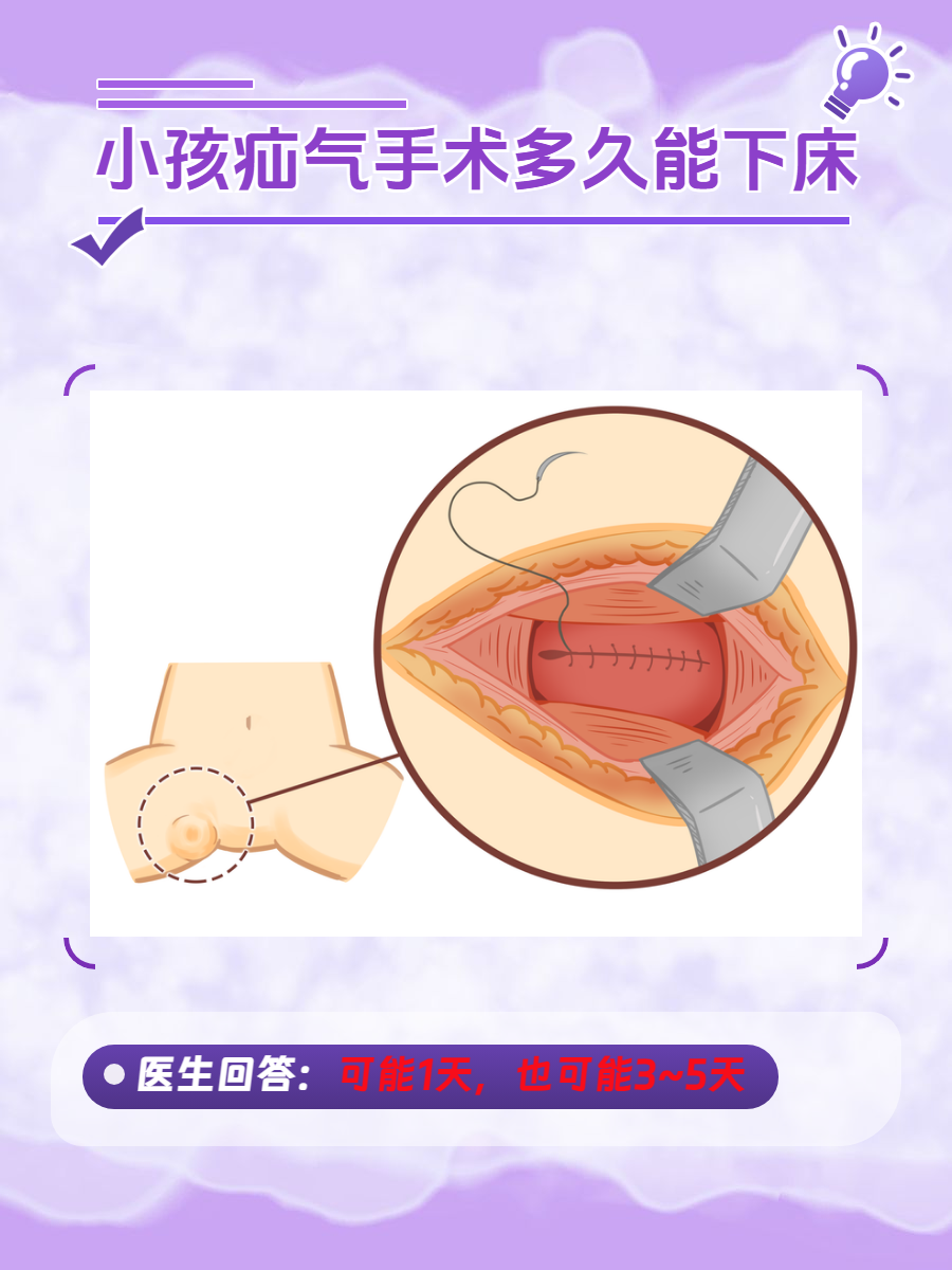 一起分析  疝气手术是临床中治疗各种疝的常用方法,如果小孩进行了