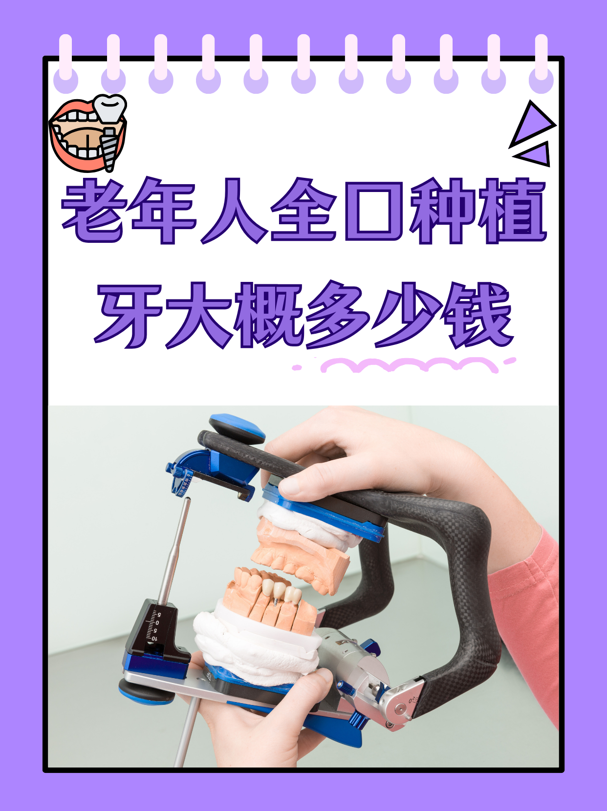 老年人全口种植牙大概多少钱     老年人全口种植牙的费用是许多家庭