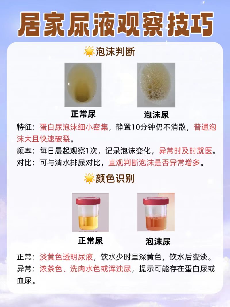 男性蛋白尿的症状表现,你知道吗?