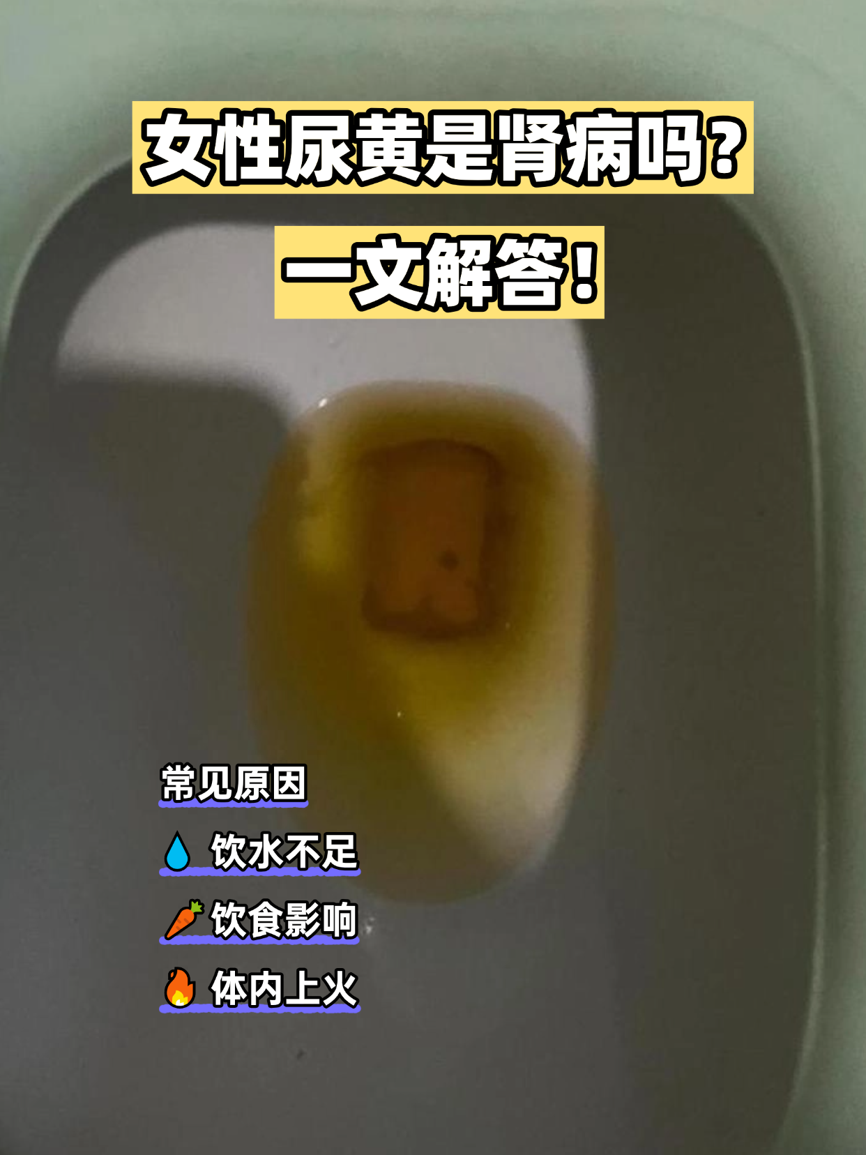 为什么尿是黄的