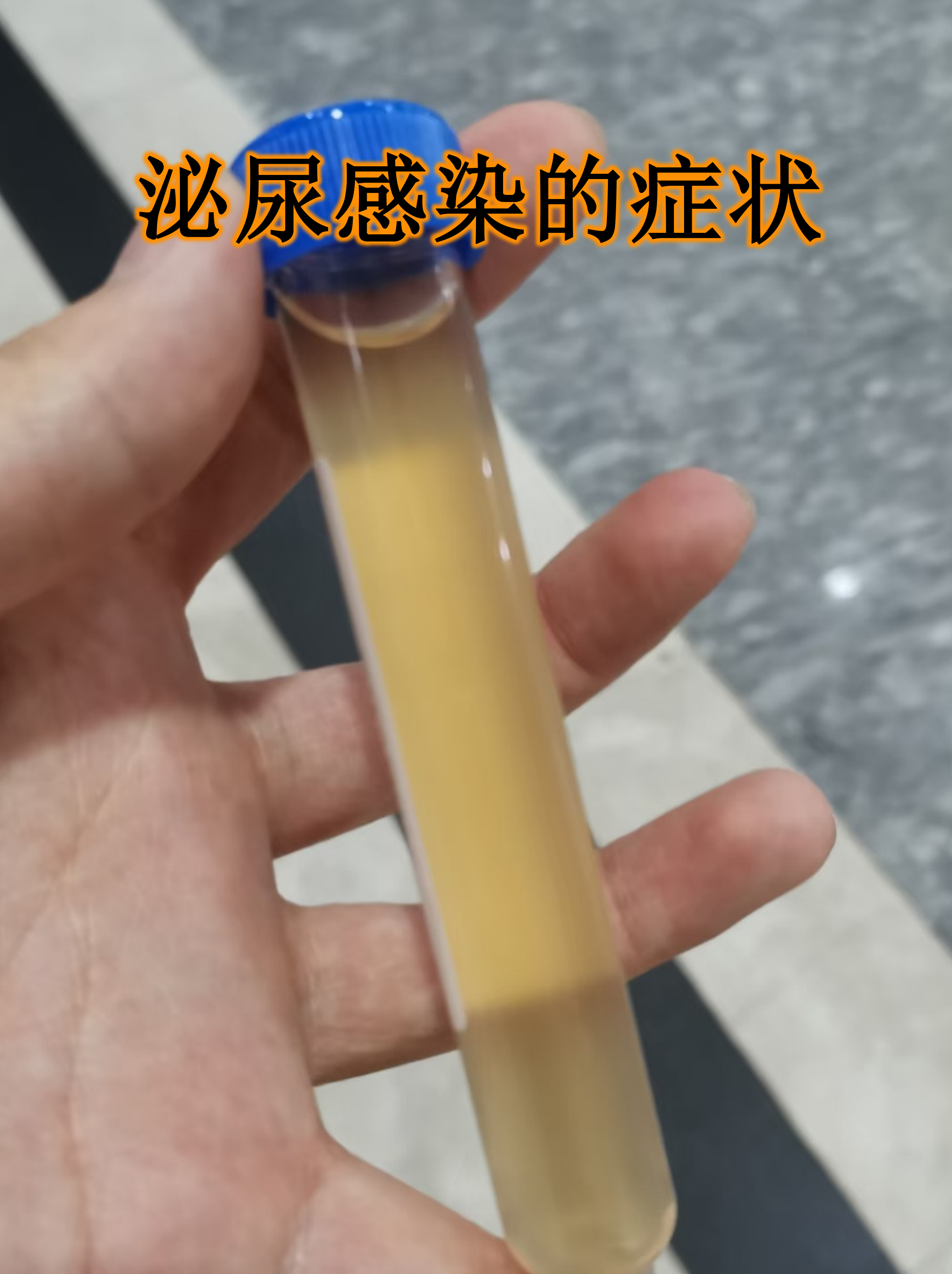 泌尿感染是许多人羞于启齿却不得