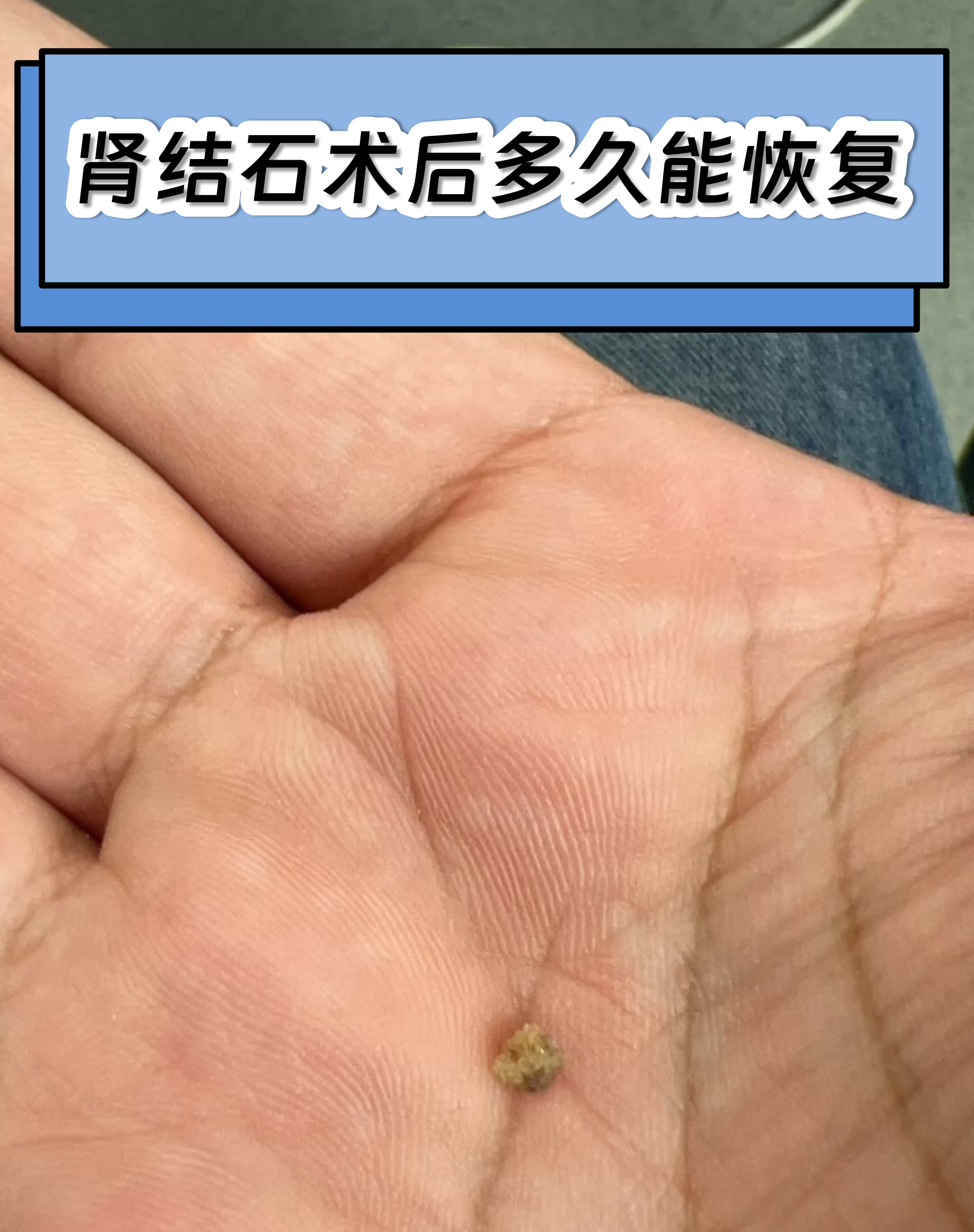 关于中国中医科学院眼科医院代挂专家号加代问诊出院居家护理提醒，科学恢复身体的信息