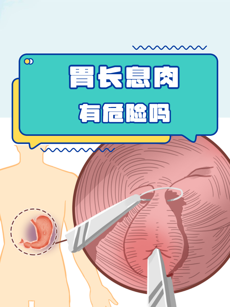 胃里为什么会长息肉