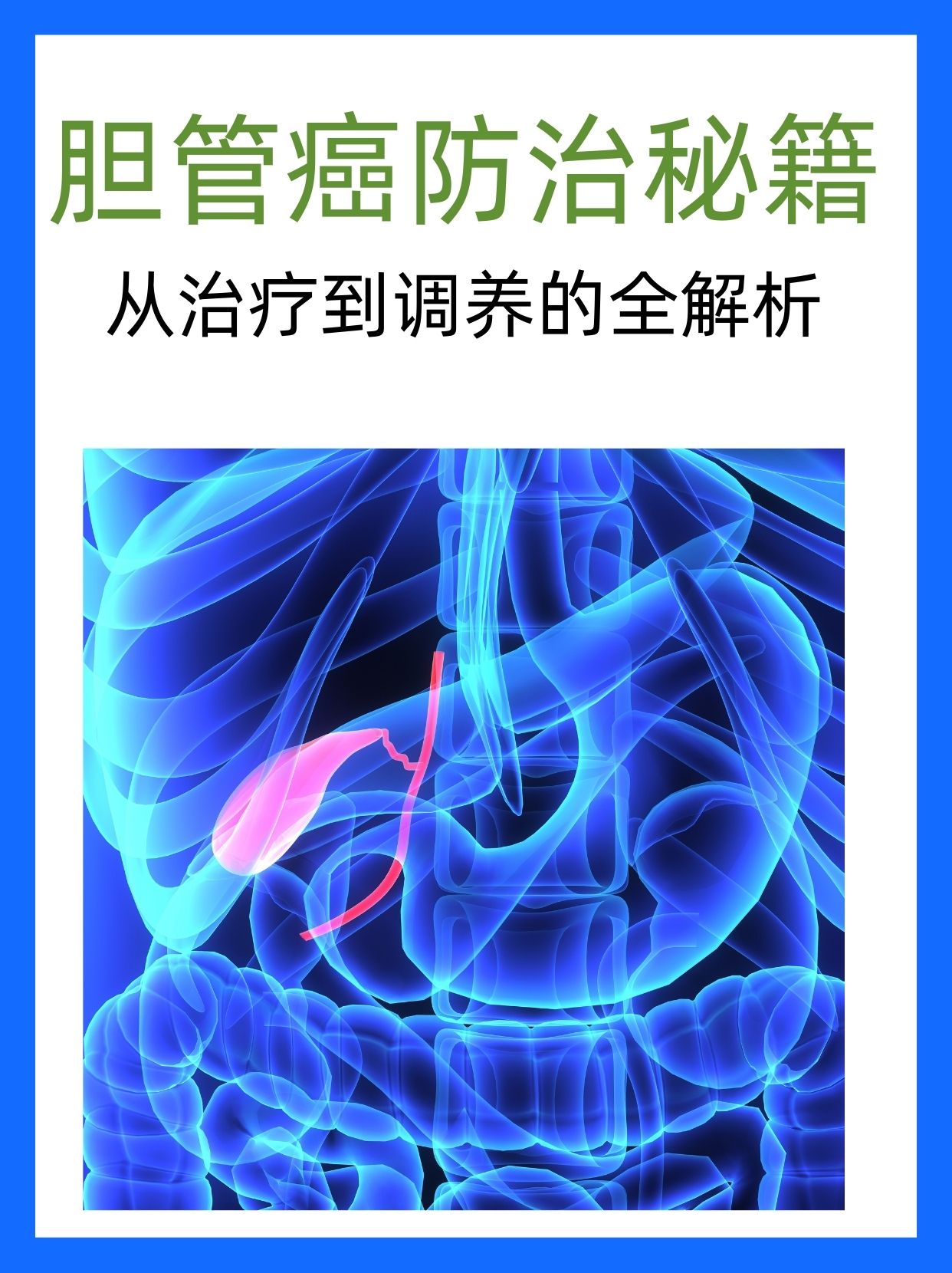 肝门部胆管癌太可怕图片