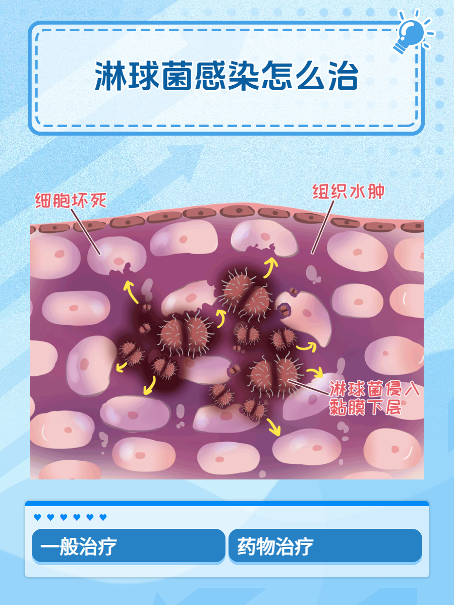 在探讨性健康的话题中,淋球菌感染无疑是一个不容