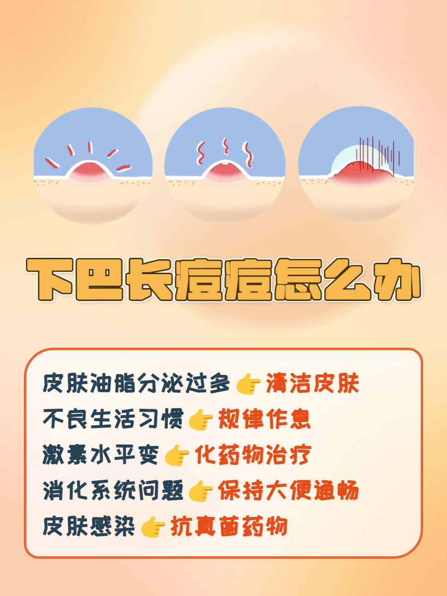 从病因到治疗一文全解析