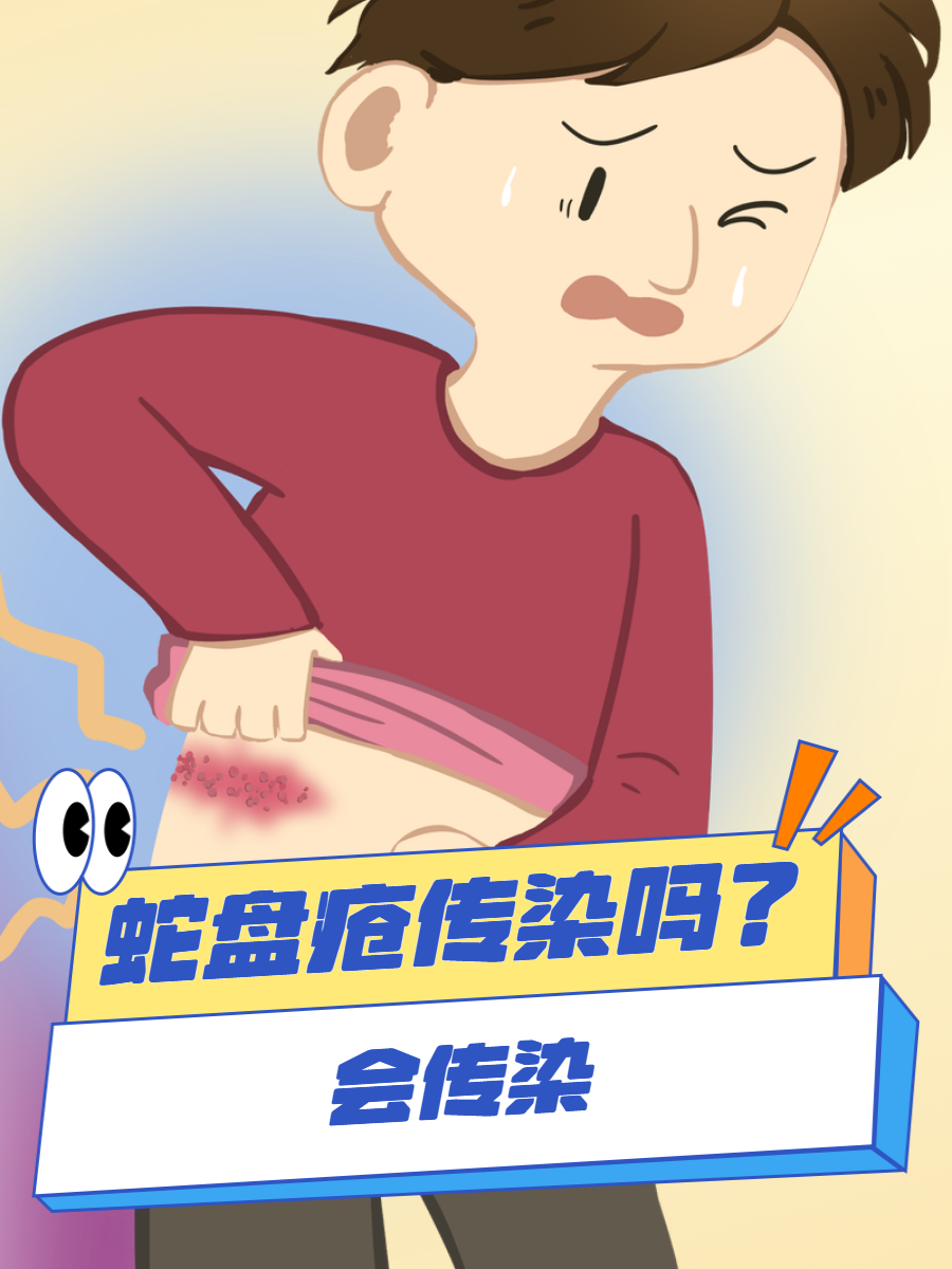 一文读懂  经常有患蛇盘疮的朋友跟我说,他们非常担心自己的病会传染