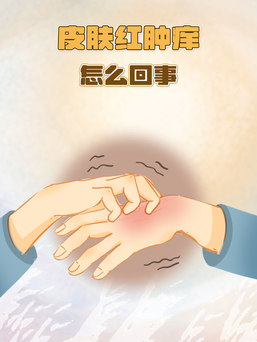 人为什么会过敏起疙瘩为什么在线