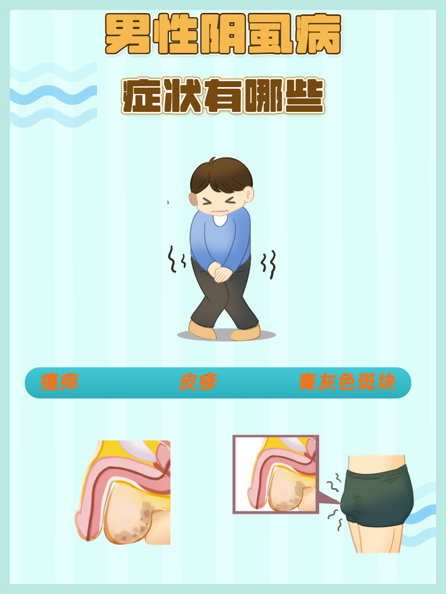 男性阴虱病症状有哪些?
