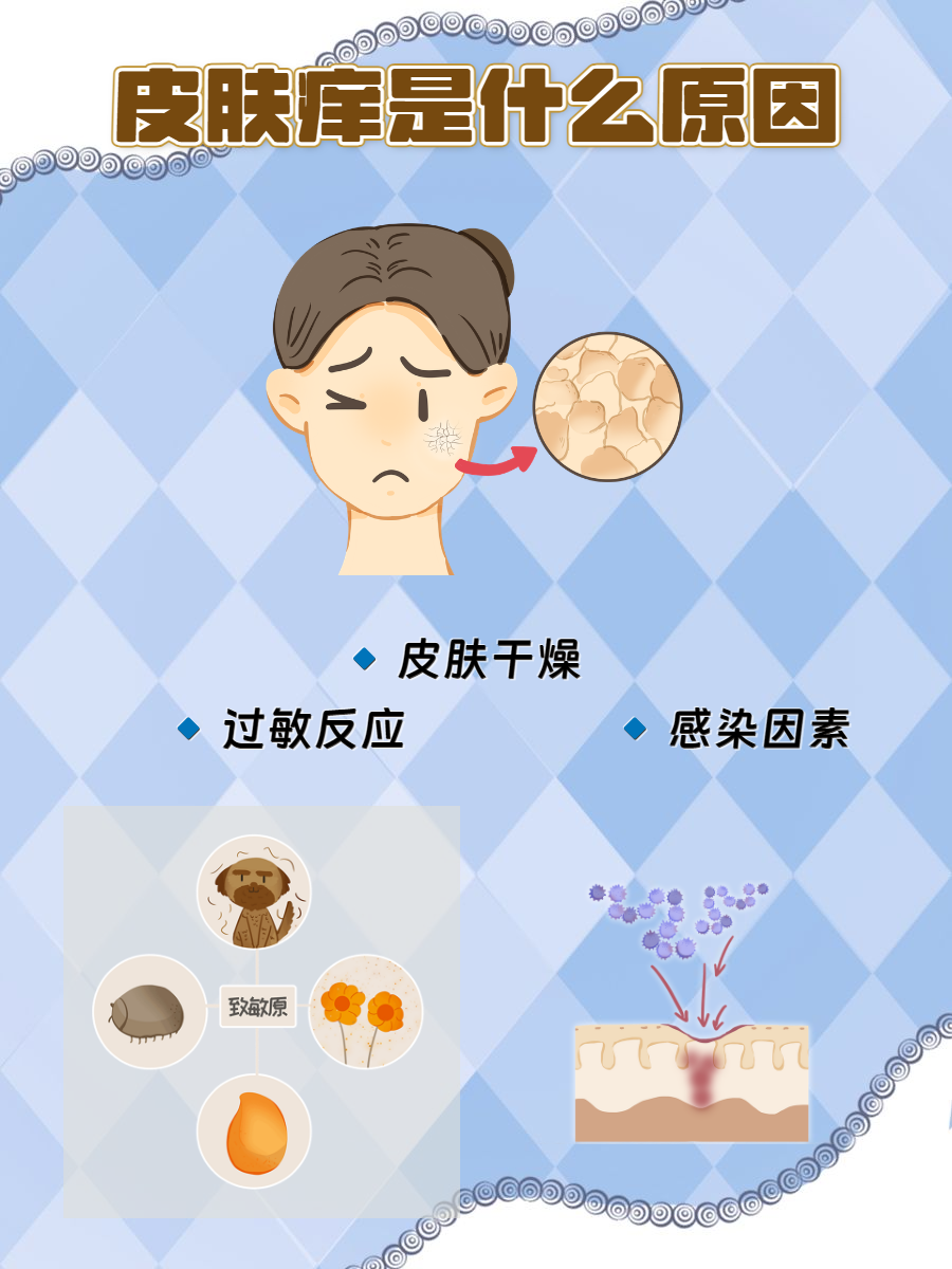 相信很多人都经历过皮肤痒的情况,瘙痒严重时还会让人