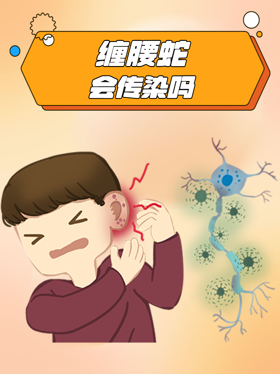 缠腰蛇会传染吗?