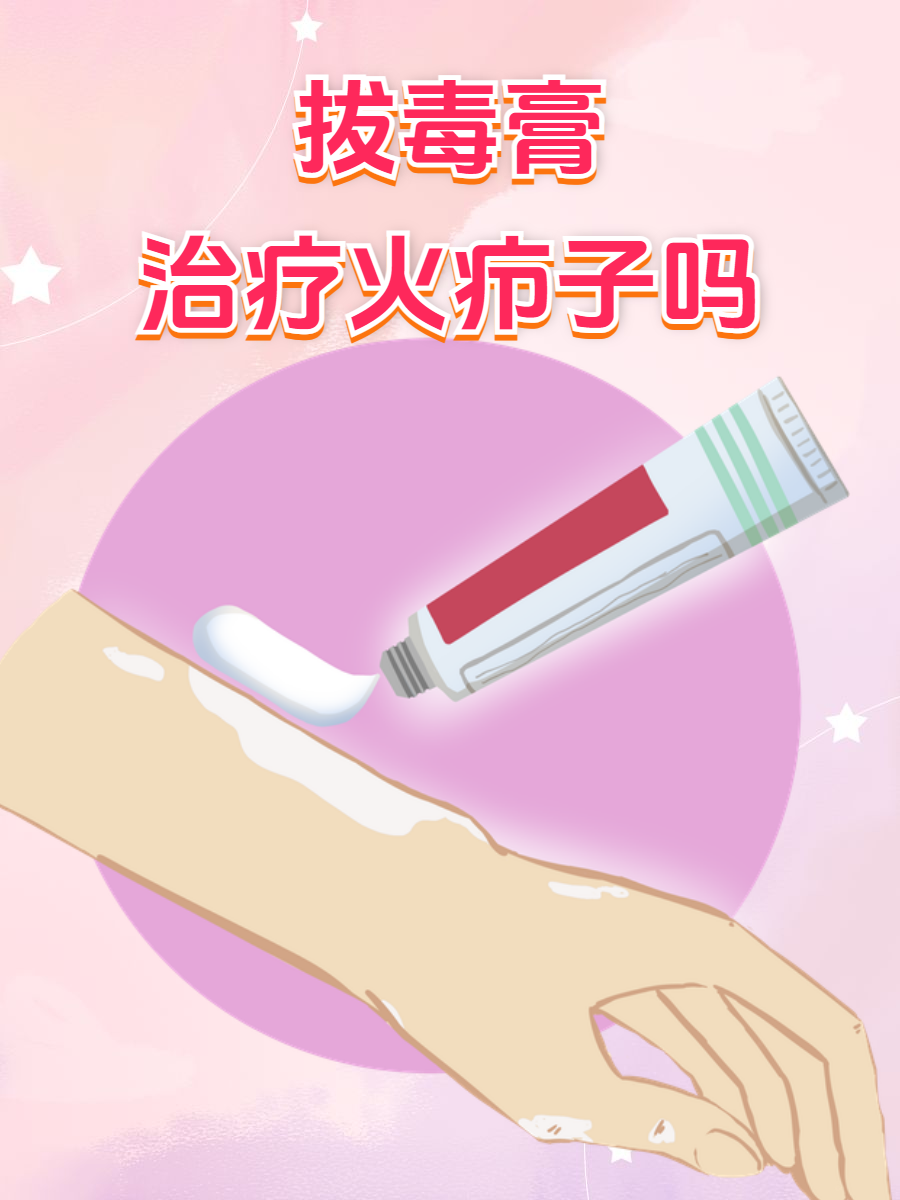 而拔毒膏作为一种传统的外用药物,它到底对火疖子有没有效果呢?