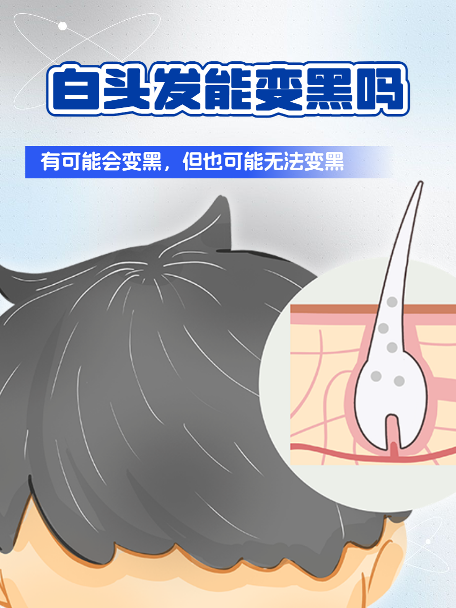 白头发为什么自己变黑了为什么在线 白头发为什么自己变黑了为什么在线