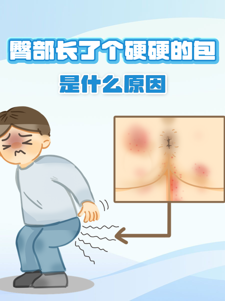 臀部长了个硬硬的包的问题,这确实可能隐藏着一些