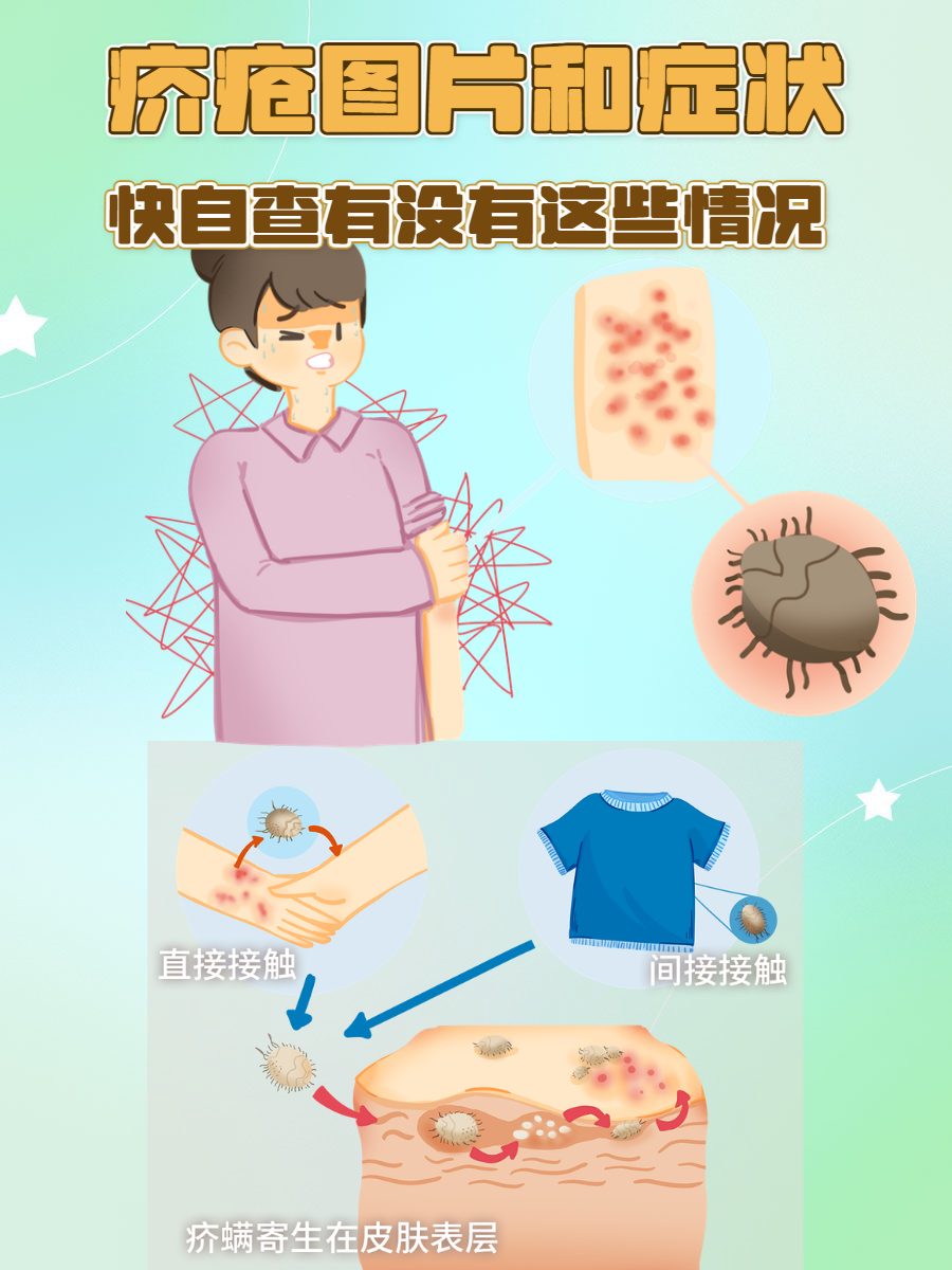 而且一到晚上,疥螨开始活跃,瘙痒
