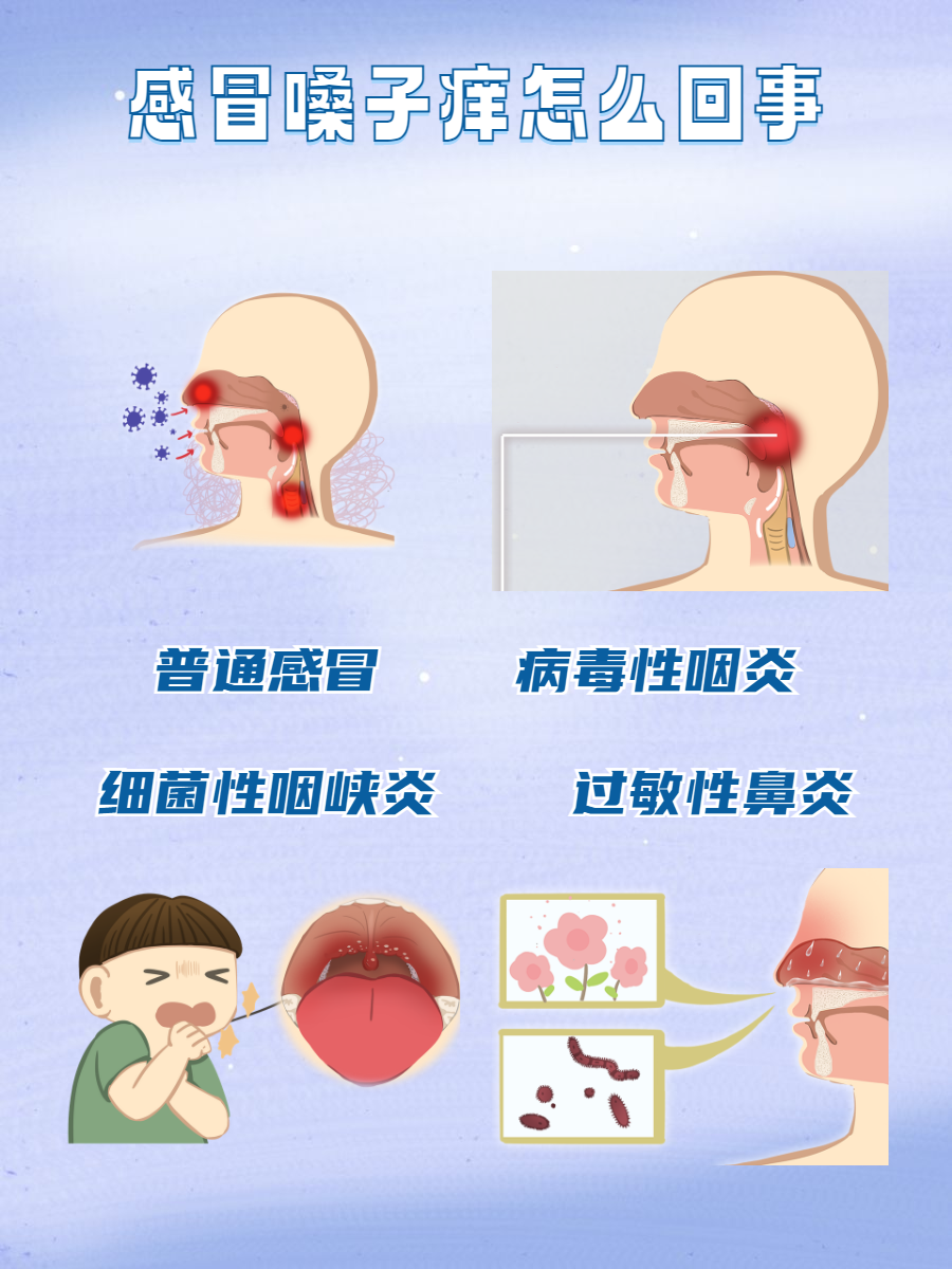 嗓子痒是怎么回事图片